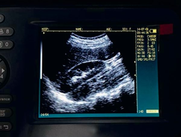 ECÓGRAFO PORTÁTIL FarmScan L60 - Imagen 2
