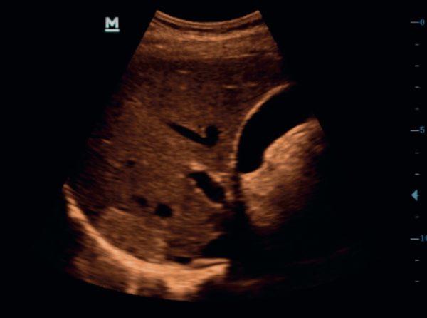 ECÓGRAFO PORTÁTIL  DP 10 - Imagen 2