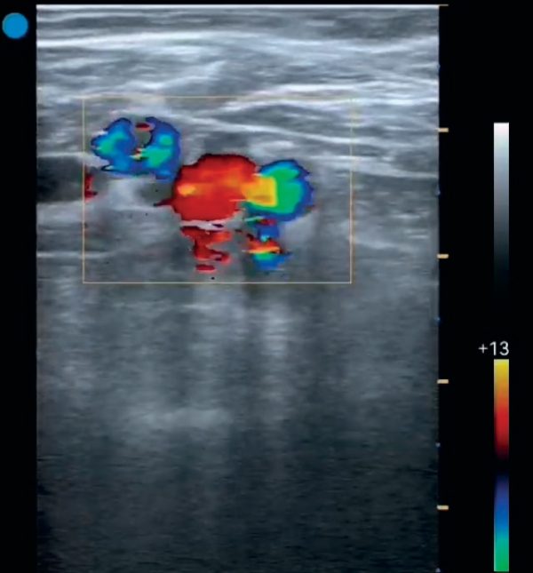 ECÓGRAFO BESTSCAN S5 PLUS - Imagen 2