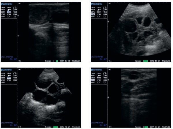 ECÓGRAFO PORTÁTIL  S1 - Imagen 3