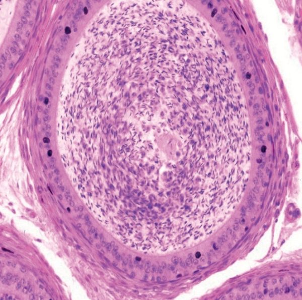 MICROSCOPIO C BINOCULAR BS-2074B - Imagen 2